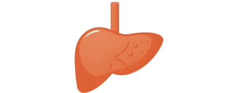 Mediterrane voeding vs vetarm