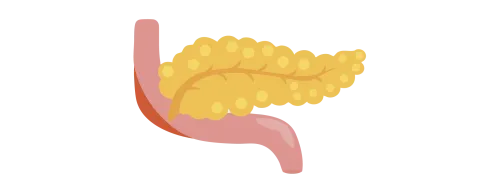 Molybdeen en cadmium negatief en positief geassocieerd met pancreaskanker