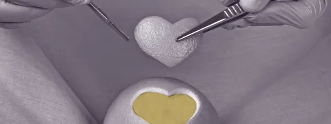 Bespoedig herstel na operatie