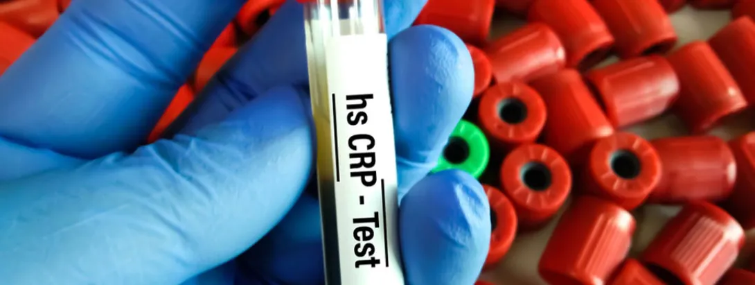 Inflamatie gevaarlijker dan cholesterol