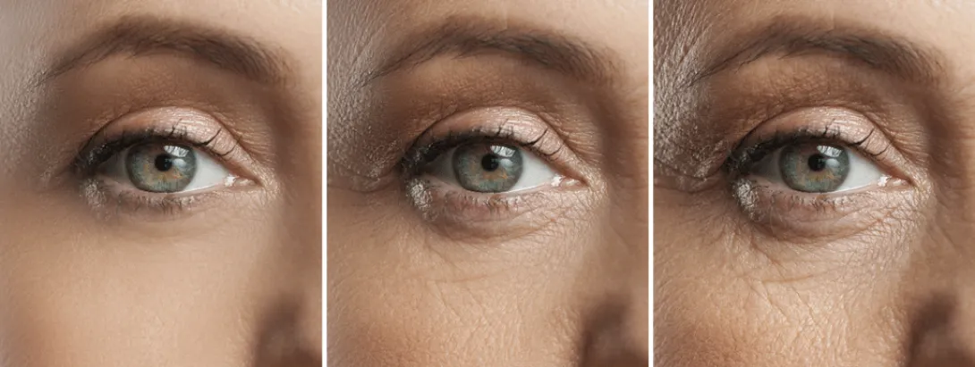 Microbioom en kraaienpootjes