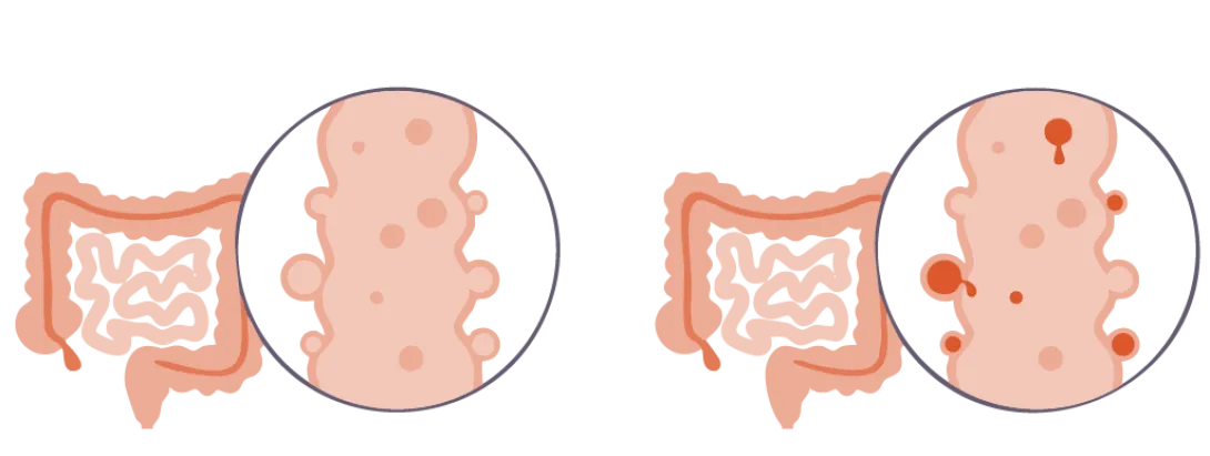 Mucuslaag van de darmen